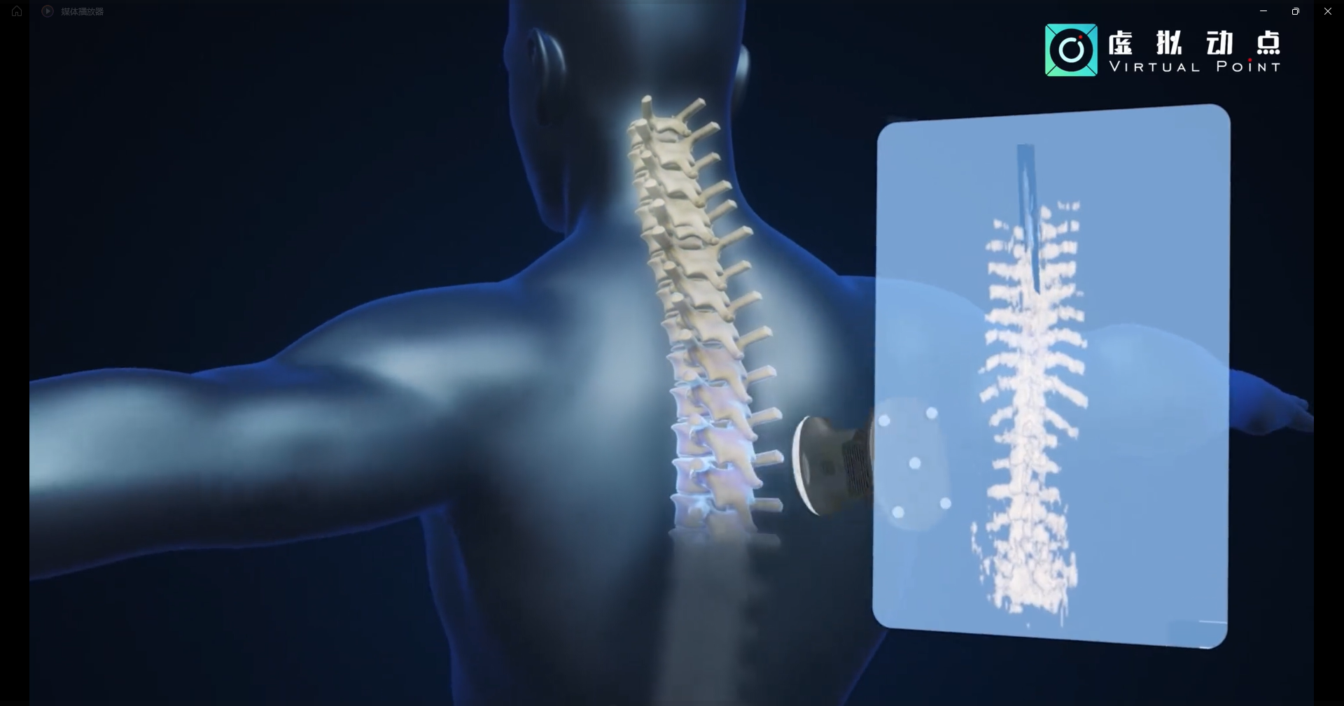环亚集团·虚拟动点OptiTrack开创3D超声成像在脊柱诊断中的应用